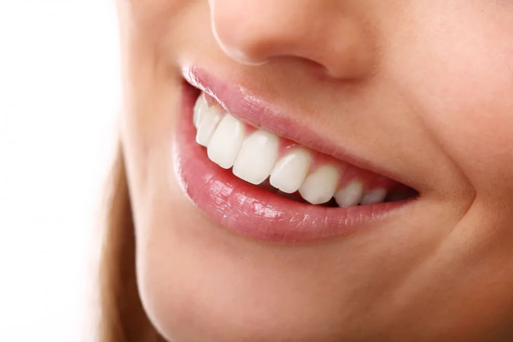 Procedimiento de blanqueamiento dental profesional en San Salvador