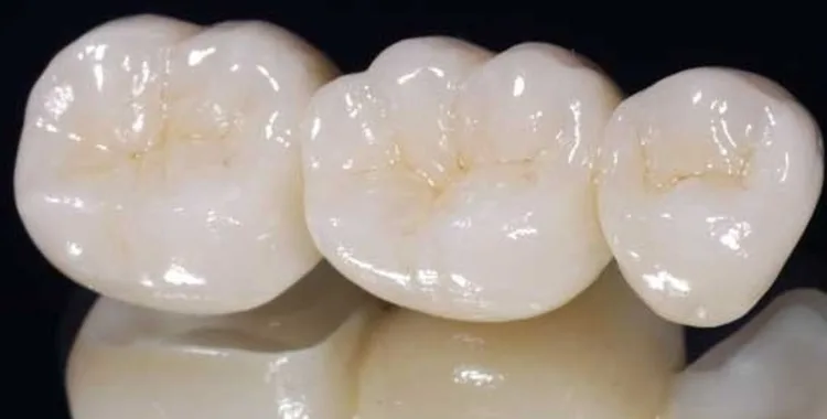 Precio de coronas y puentes de zirconio en El Salvador