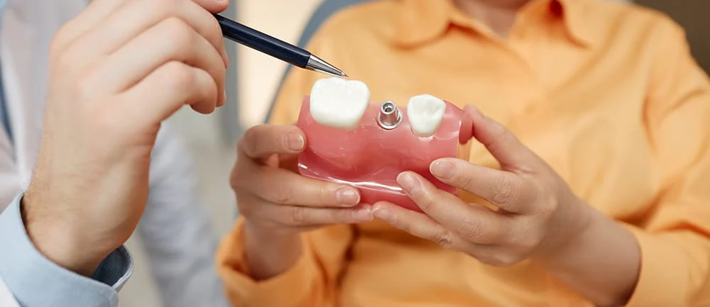 costo implante el salvador dr carlos santos costo implante El Salvador